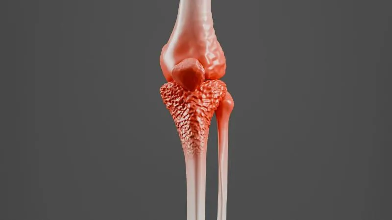 Chirurgie oncologique orthopédique