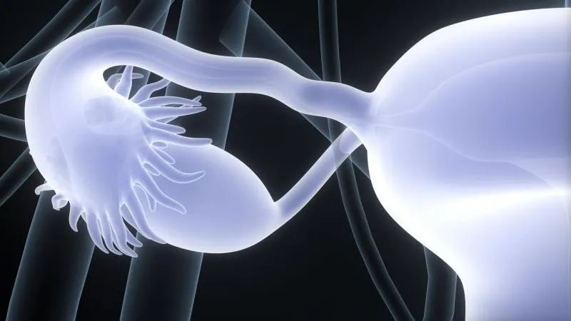 Chirurgie du cancer de l’ovaire