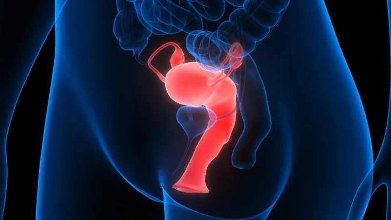 Hystérectomie pour cancer - chirurgie d’ablation de l’utérus