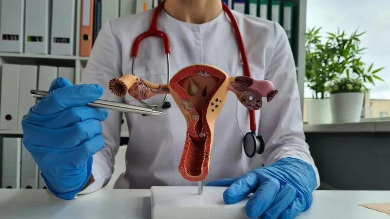 Hystérectomie radicale pour le cancer du col de l’utérus
