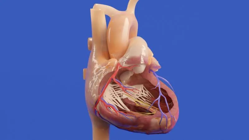 Remplacement valvulaire mitral par cathéter (TMVR)