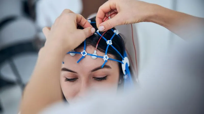 Chirurgie de stimulation cérébrale profonde - Chirurgie DBS