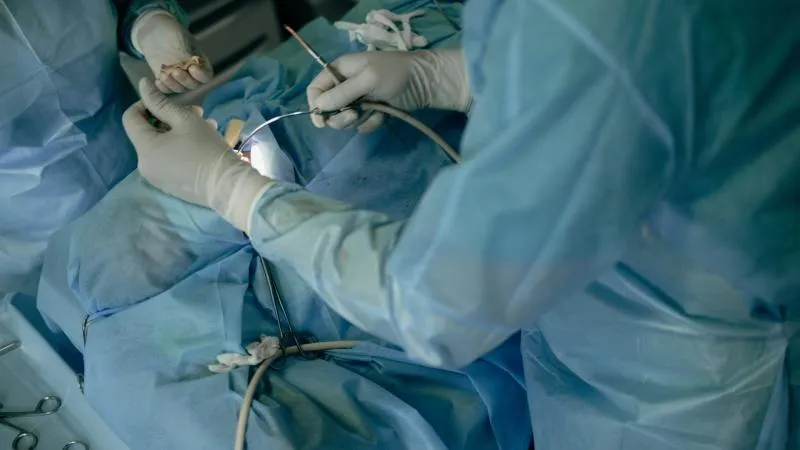 Prostatectomie laparoscopique
