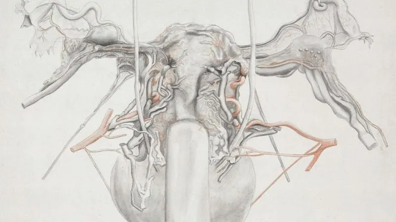 Varicocélectomie - chirurgie de la varicocèle