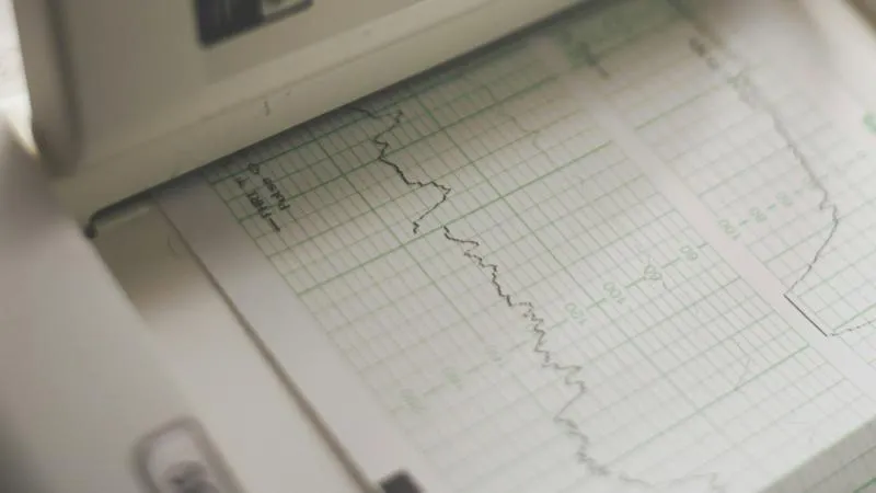 Soins intensifs cardiaques (unité de soins intensifs cardiaques)