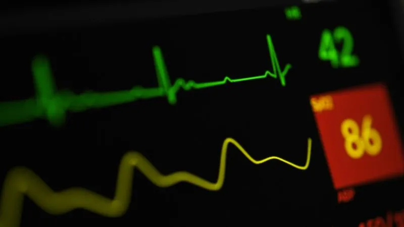 Unité de soins intensifs cardiologiques (USIC)