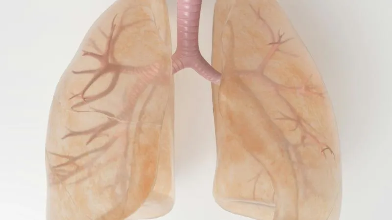 Lobectomie - chirurgie d’ablation d’un lobe pulmonaire
