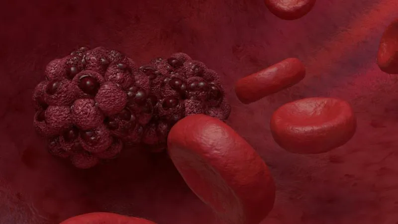 Embolisation tumorale