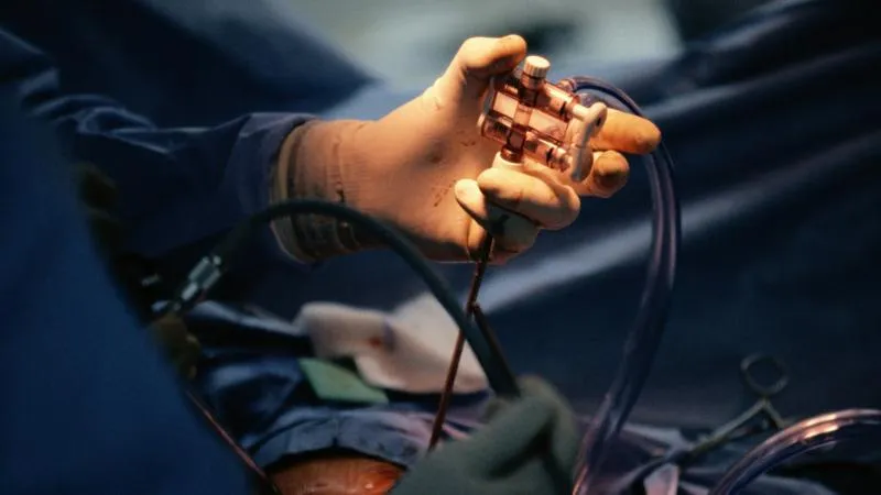 Pose d’endoprothèse biliaire - stent des voies biliaires