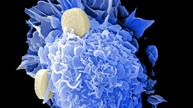 Médicaments intelligents contre le cancer - Thérapie ciblée