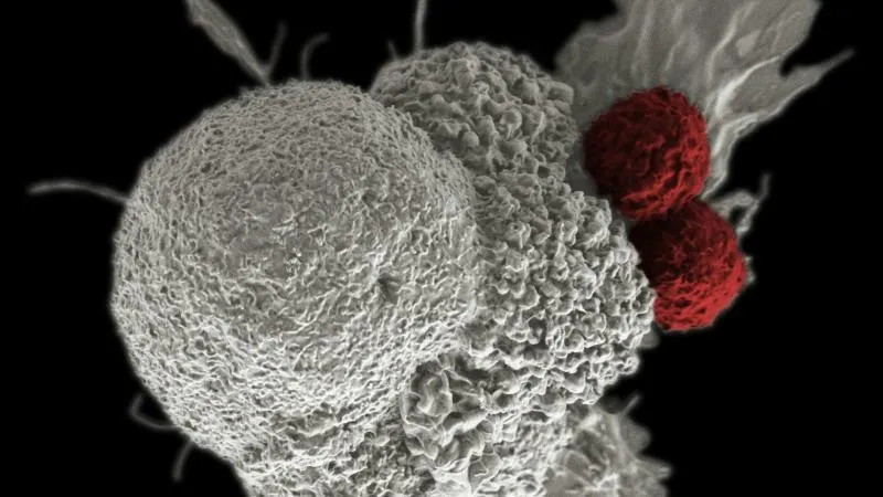 Thérapie ciblée du cancer - Traitement de précision du cancer