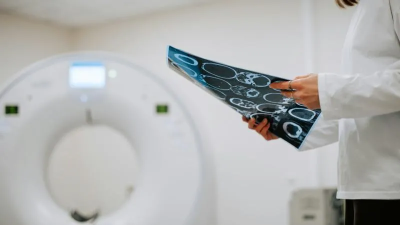 TEP/TDM au PSMA - Imagerie du cancer de la prostate