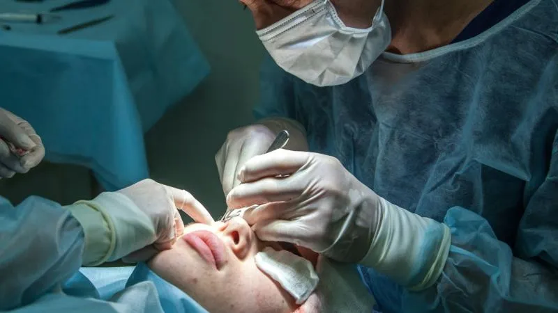 Rhinoplastie
