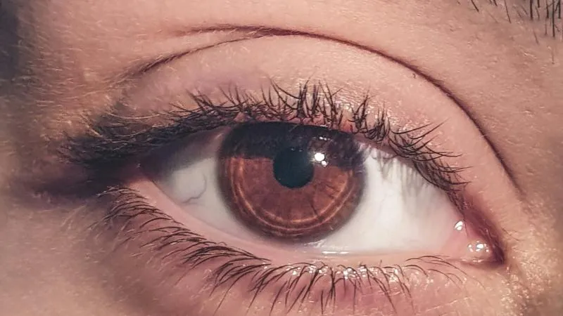 Blépharoplastie - chirurgie des paupières