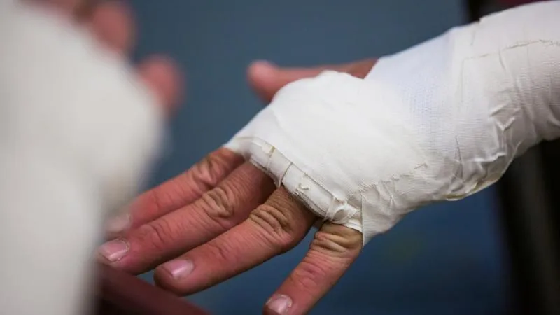 Chirurgie de reconstruction des brûlures