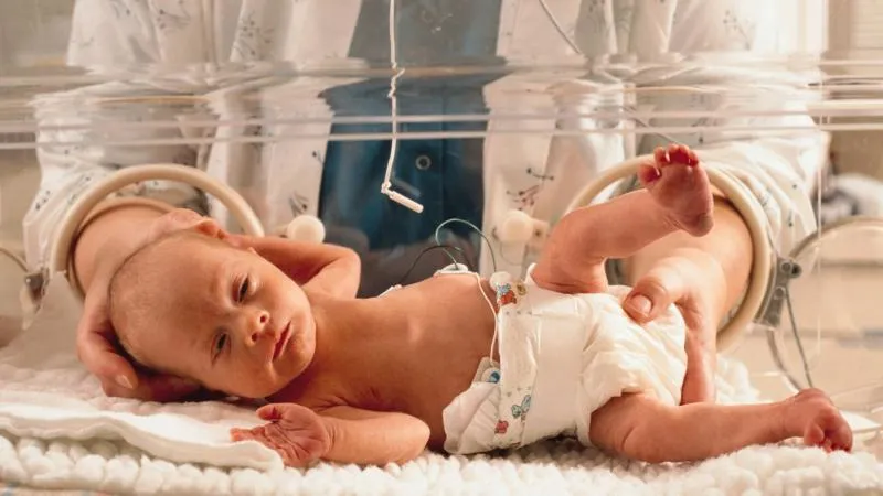 Cure de hernie inguinale par laparoscopie chez l’enfant