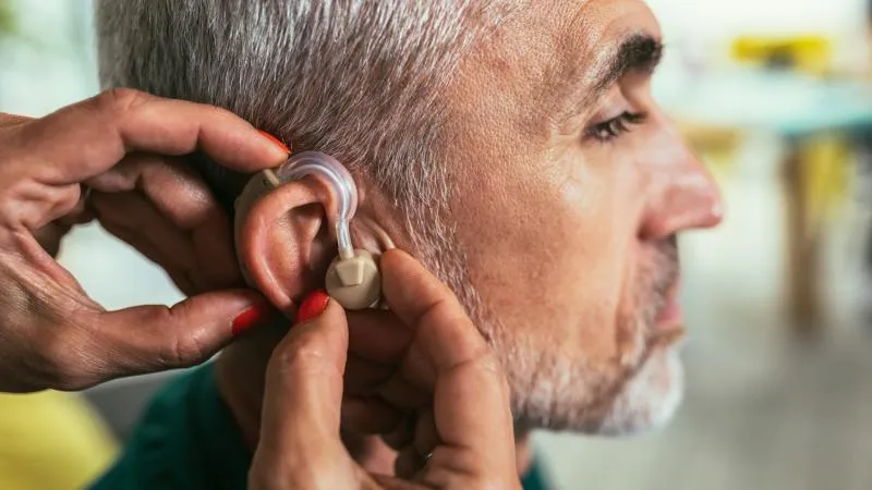 Chirurgie d’implant cochléaire - Chirurgie d’implant auditif
