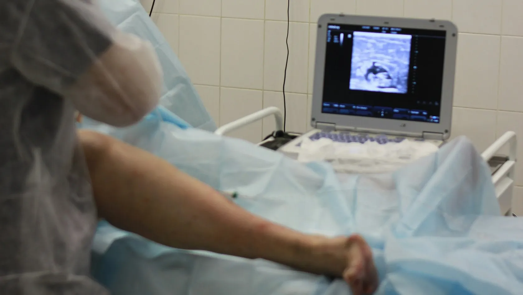 Chirurgie robotique de prothèse du genou