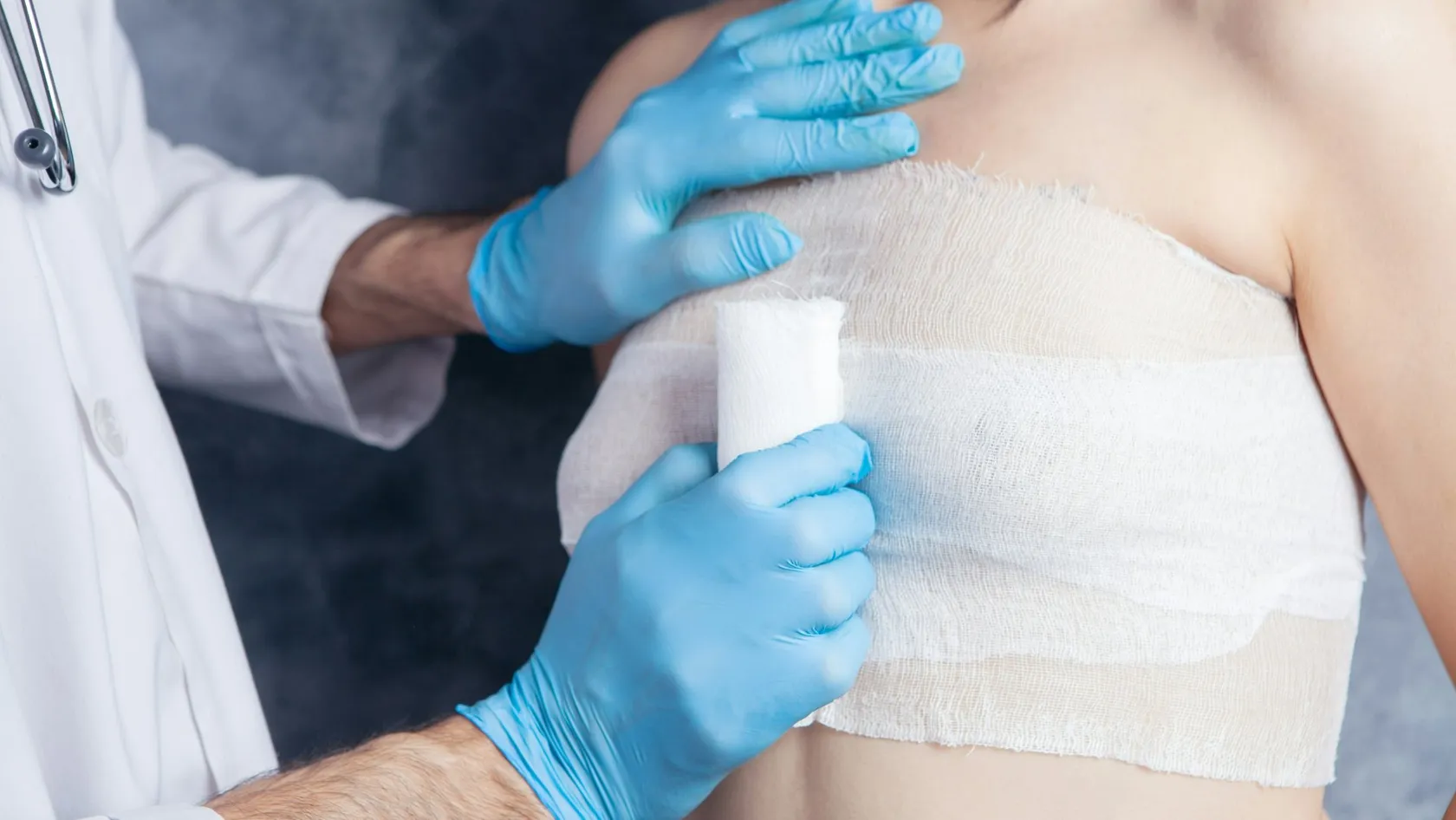 Chirurgie oncoplastique du sein