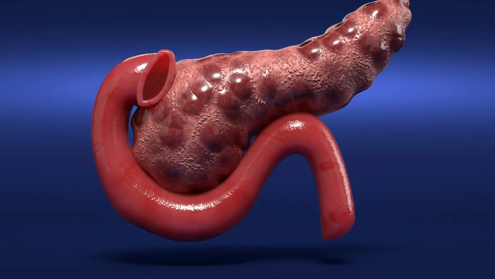 Chirurgie du cancer du foie