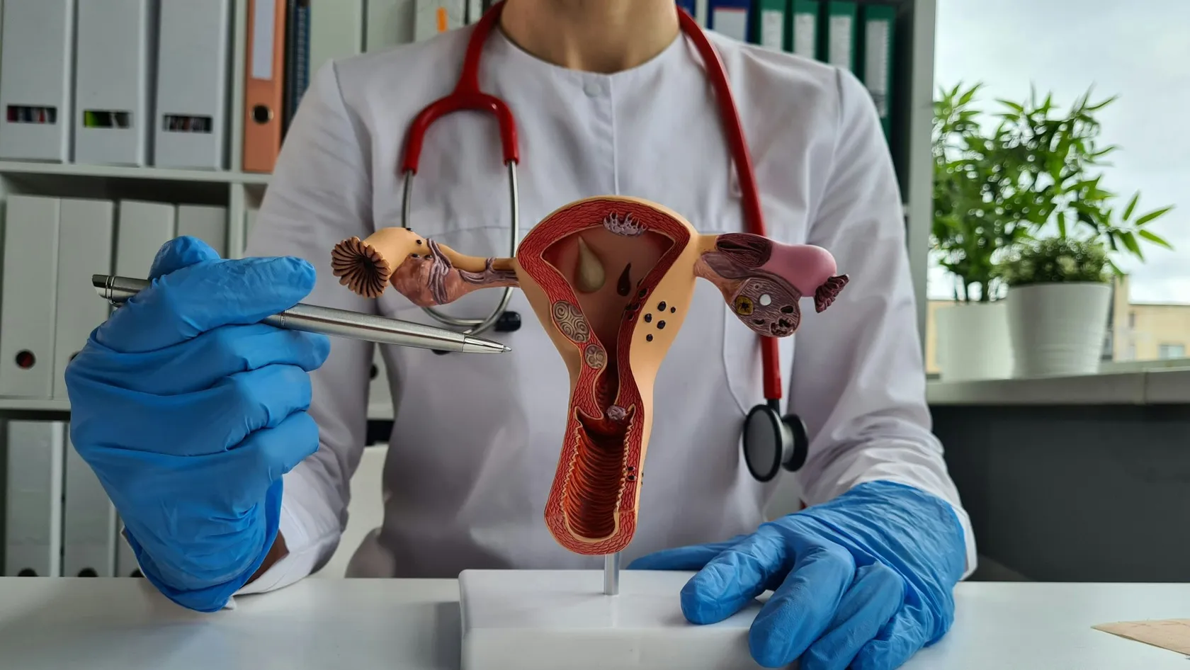 Hystérectomie radicale pour le cancer du col de l’utérus