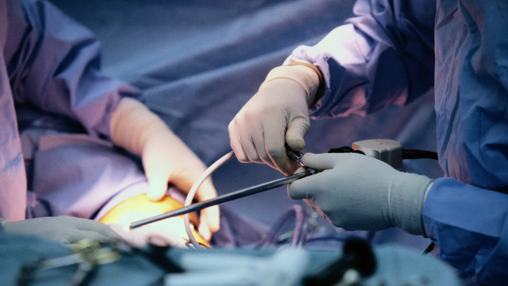 Chirurgie laparoscopique - chirurgie mini-invasive