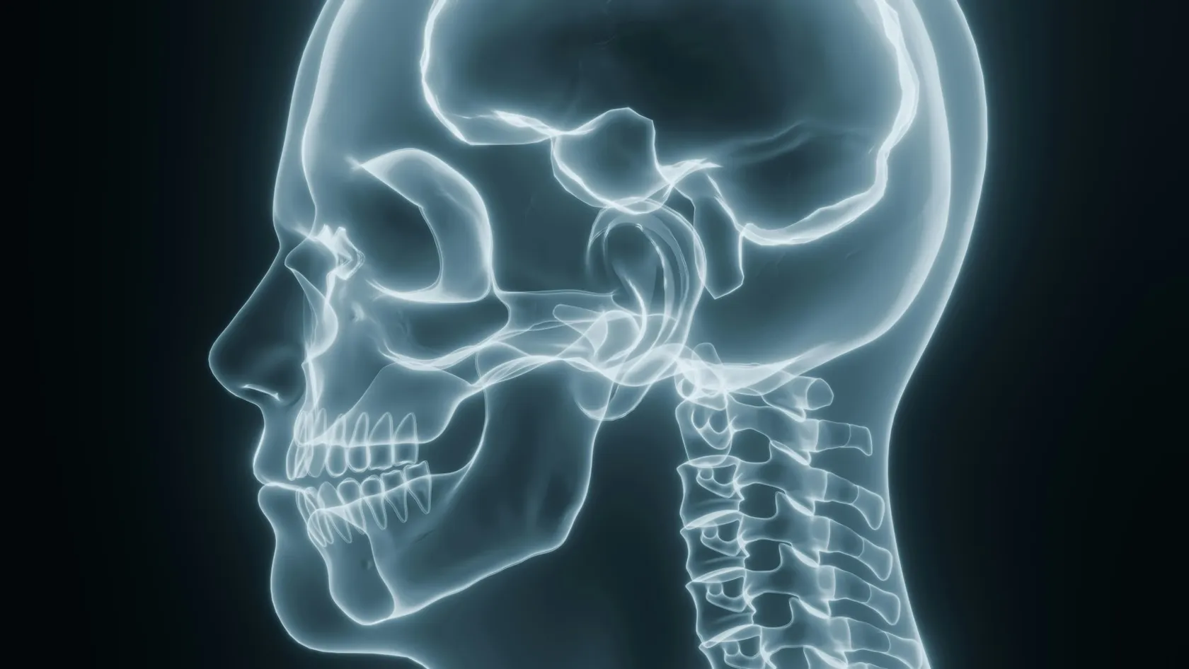 Chirurgie de la malformation de Chiari
