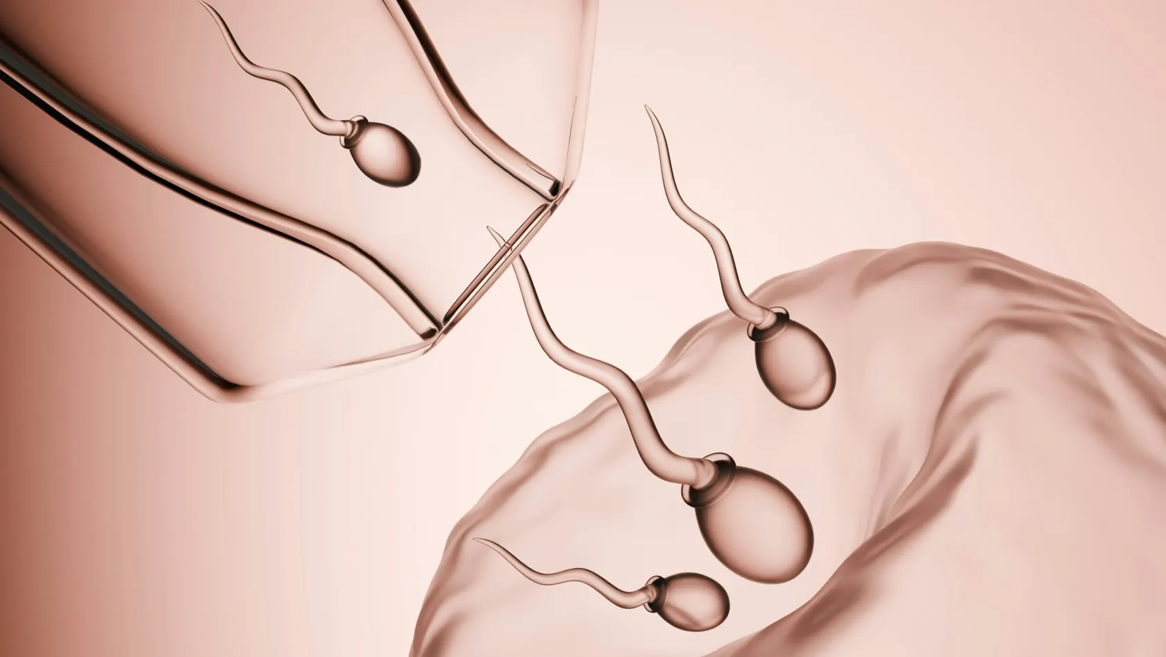 TESE microchirurgicale - Extraction de spermatozoïdes testiculaires