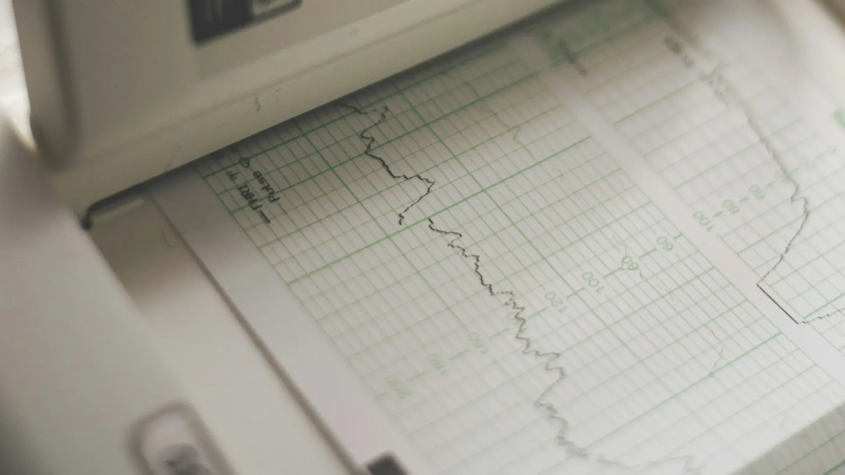 Soins intensifs cardiaques (unité de soins intensifs cardiaques)