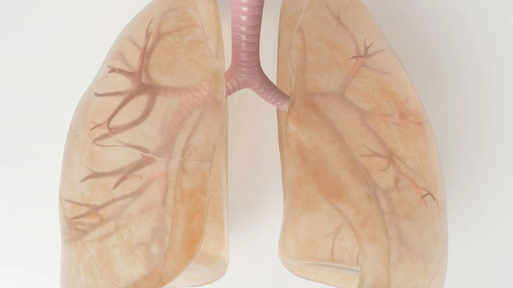 Lobectomie - chirurgie d’ablation d’un lobe pulmonaire