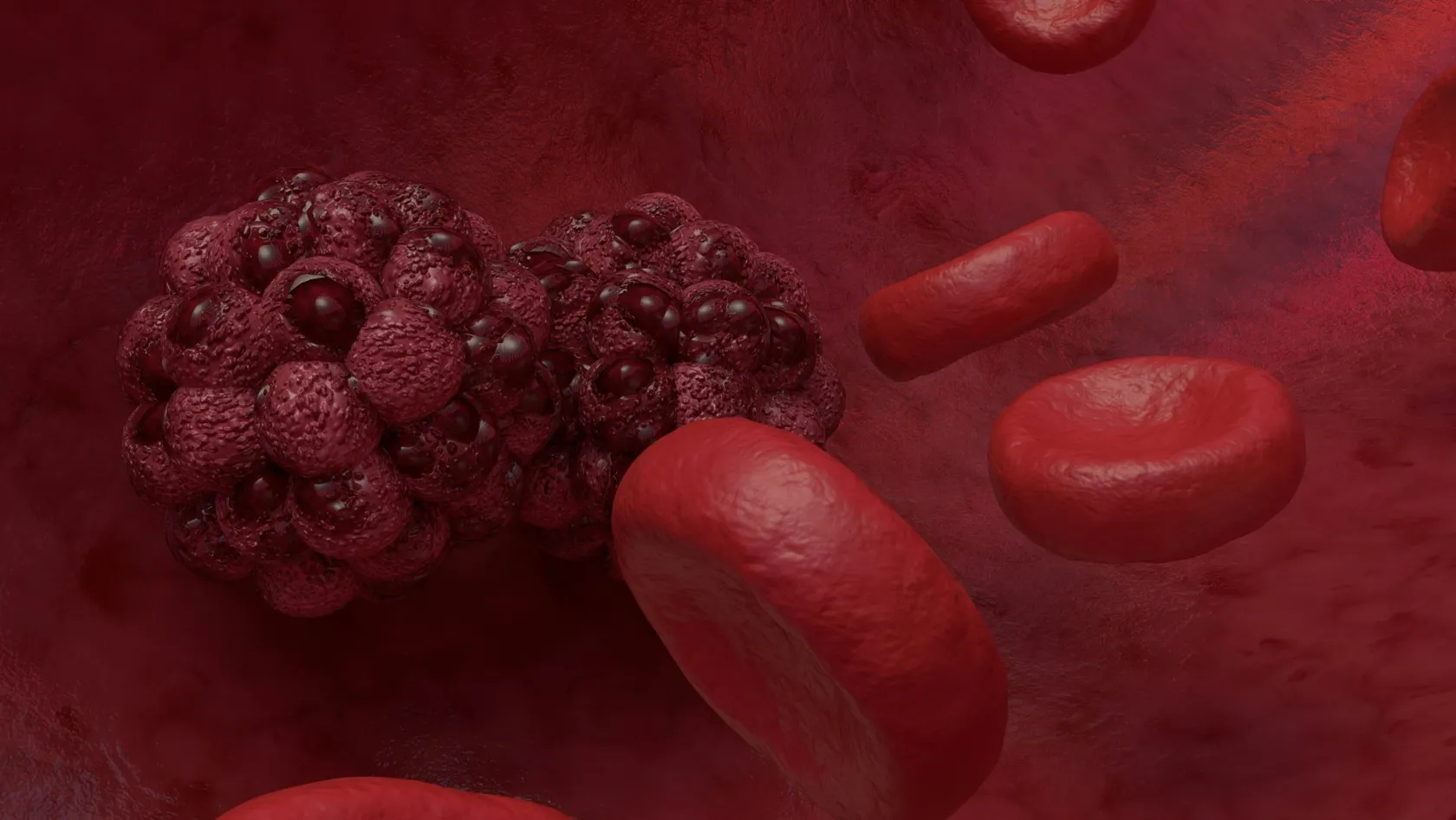 Embolisation tumorale