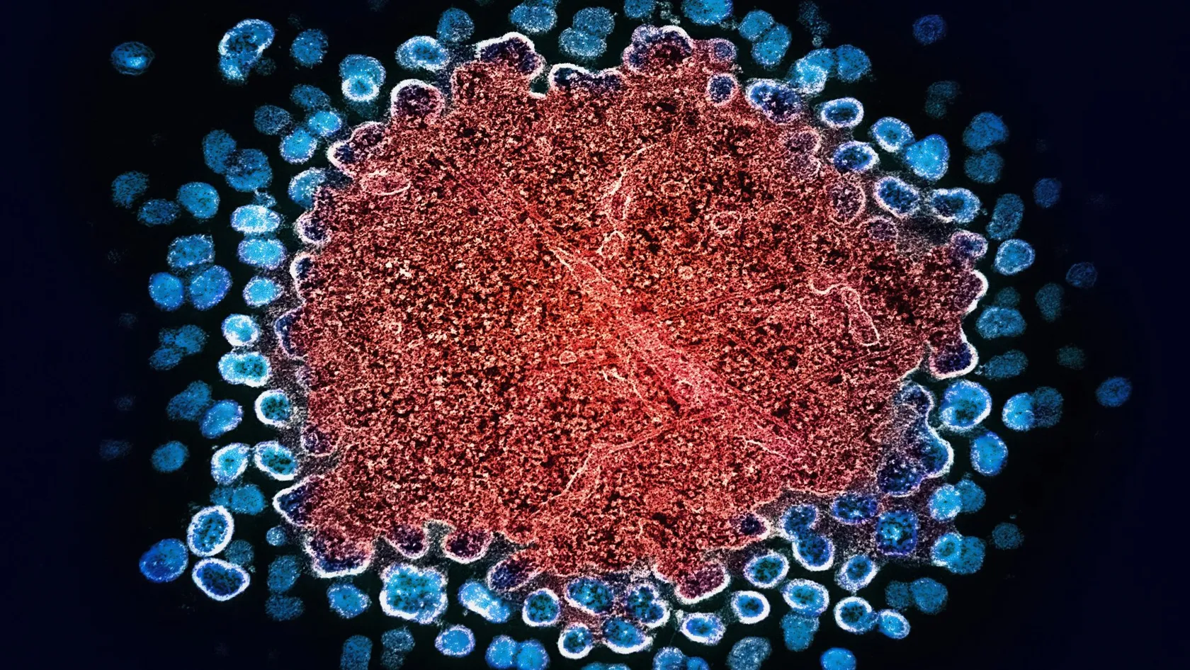 Thérapie par sacituzumab govitécan - Trodelvy