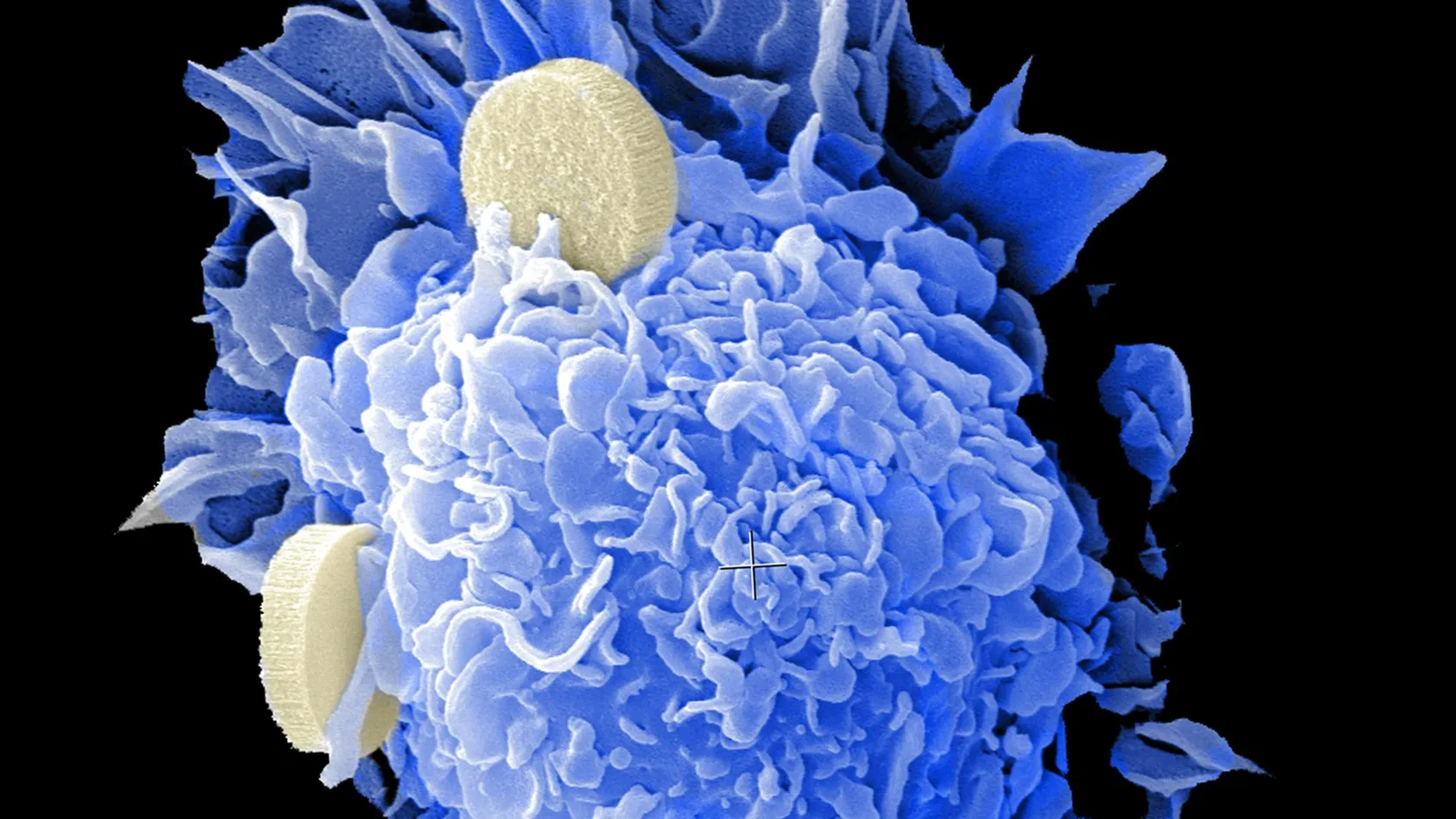 Médicaments intelligents contre le cancer - Thérapie ciblée
