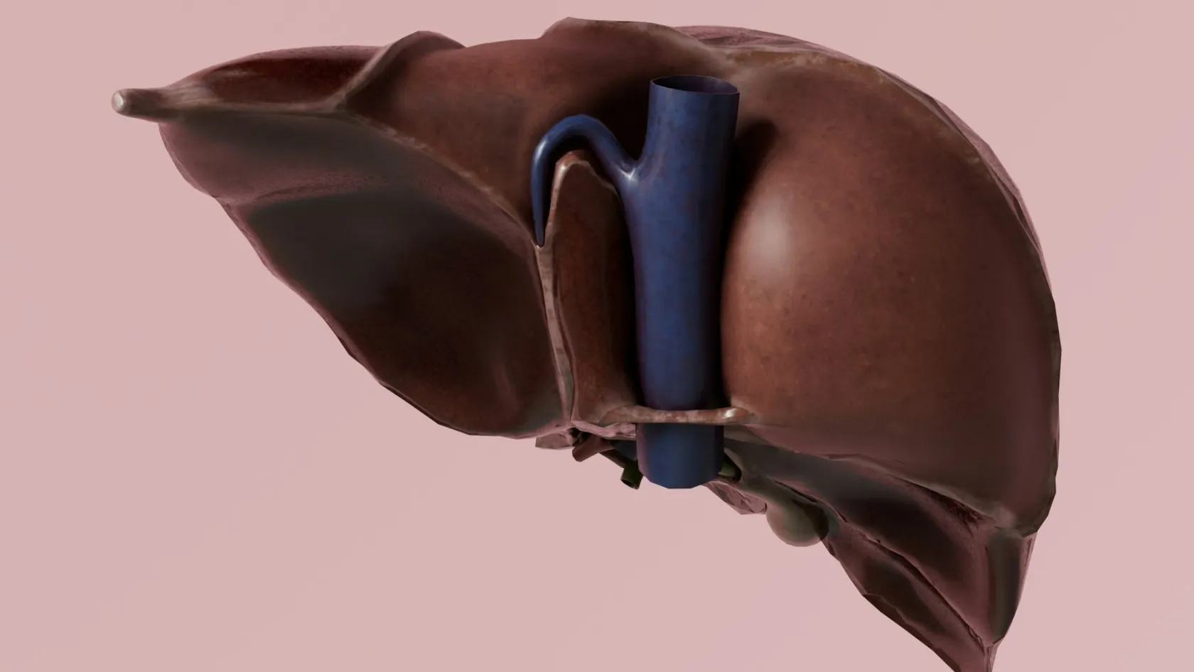 Transplantation hépatique pour atrésie des voies biliaires