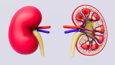 Chirurgie des calculs rénaux