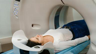 Irradiation corporelle totale - TBI