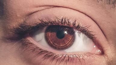 Blépharoplastie - chirurgie des paupières